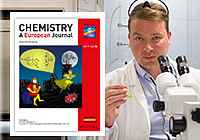 Artificial Anion Transporters for Biomedical Application
