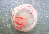 Agiogenesis in the tumor by CAM assay.jpg